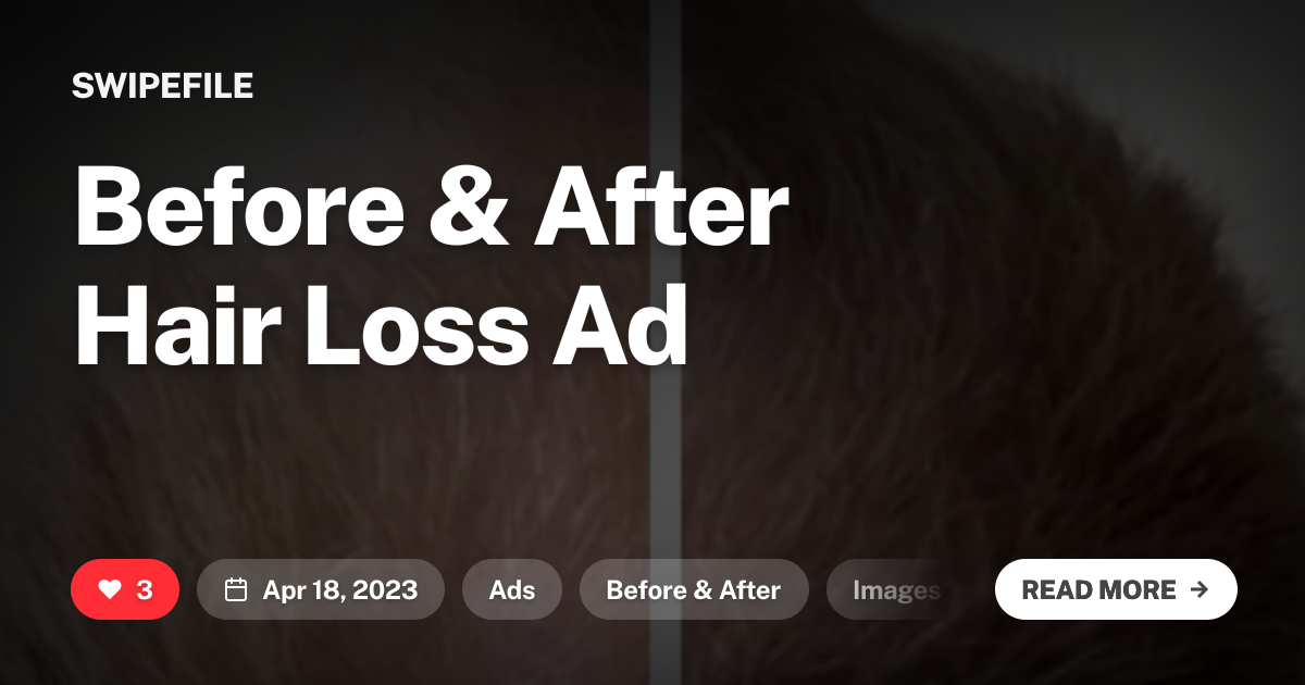 Before &amp; After Hair Loss Ad